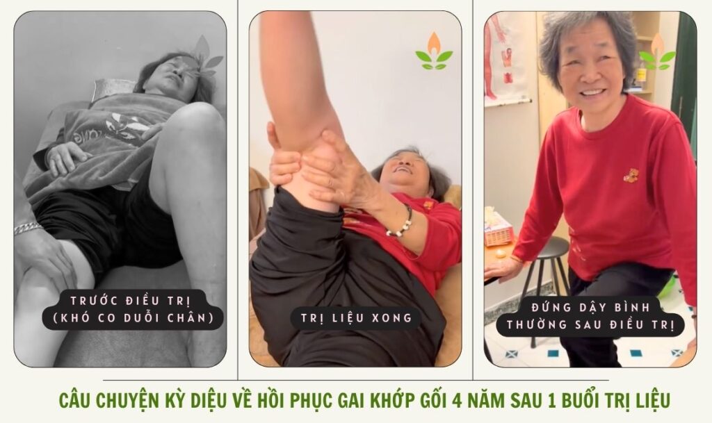 Trước điều trị